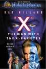 X - THE MAN WITH THE X-RAY EYES